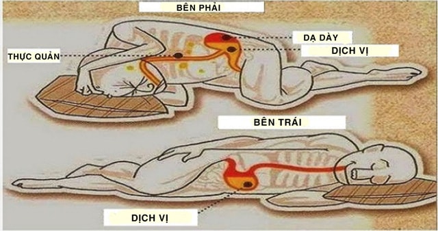 Cấu hệ hệ bạch huyết trong cơ thể người